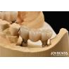 China Zirconia Implants Perfect Match With Natural Teeth Zero Allergy Risk wholesale