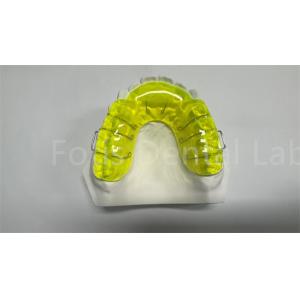 Safe Miechigan Retainer Expander / Orthodontic Spacer Appliance Convenient
