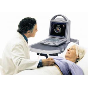 High Resolution Laptop Color Doppler Machine With 10.4 Inch LCD Monitor Angle Adjustable