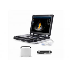 China High Quality 2D Full Digital Color Doppler Machine For Pregnancy Test With Convex Probe supplier