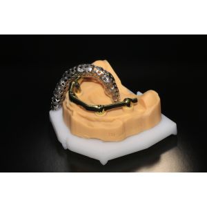 China Class 5 All On 4 AOX Implants With Hybrid Titanium Bar / Clips / Metal Mesh / Full Denture wholesale