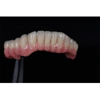 China High Success Rate All On Four All On Six  Zirconia Titanium Dental Implants Customized on sale