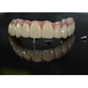 Zirconia Dental Crown: Natural-looking Teeth, Durable & Secure