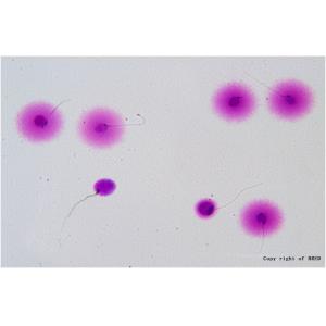 BRED Sperm DNA Fragmentation Test Kit 24 Months Shelf Life