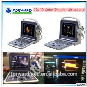 China Color doppler 10.4 inch LED Display Digital Portable Laptop Color Doppler Ultrasound supplier