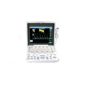 China 12.1-inch LED Screen Portable Color Ultrasound Scanner Color Doppler Machine With B+PW(Duplex) Function supplier