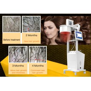 China 650nm Laser Hair Growth Machine Scalp Treatment Regrowth Salon Equipment supplier