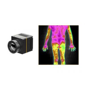 Infrared Thermal Camera Module Specially Developed For Medical Diagnosis