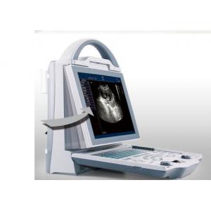 Home Ultrasound Machine Portable Ultrasound Scanner with Only 4.5kgs Weight