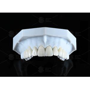 Translucide CAD EMAX Veneur Polissé Réparations en céramique vitrée pour les zones antérieures et postérieures