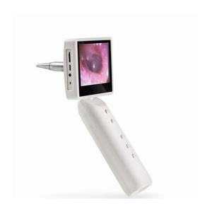 China Video Otoscope Ophthalmoscope Ear Checking With Removable Rechargeable Battery supplier