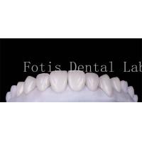 China Polishing Finishing Cosmetic Teeth Veneer Covers  For Beautiful Smile on sale