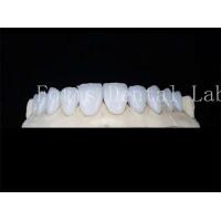 China Customized Natural Porcelain Veneers Dental Lab Veneers Stain Resistant on sale