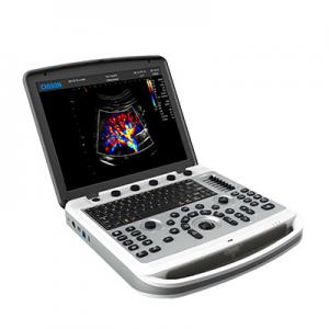 120° Rotatable Chison SonoBook 6 Portable Laptop Ultrasound Machine